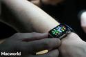 Apple Watch is the touchscreen device that can touch you back. 